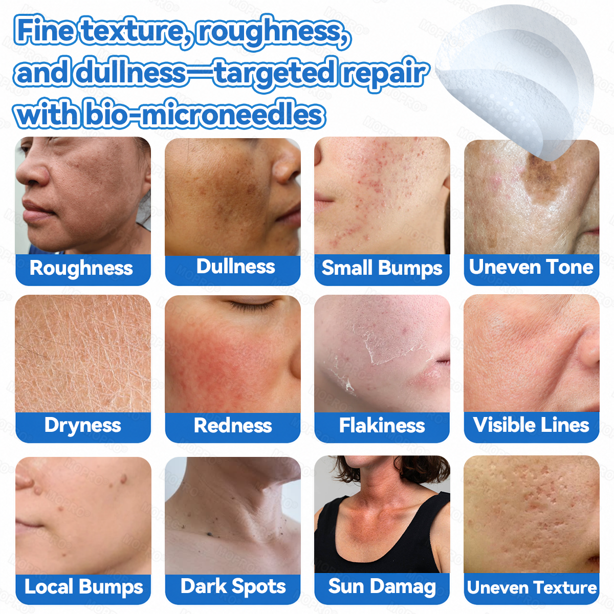 ✅ 𝐌𝗢𝑷𝙍𝙊® 𝟐-𝐢𝐧-𝟏 𝐌𝐢𝐜𝐫𝐨𝐧𝐞𝐞𝐝𝐥𝐞 & 𝐇𝐲𝐝𝐫𝐨𝐜𝐨𝐥𝐥𝐨𝐢𝐝 𝐏𝐚𝐭𝐜𝐡 | 𝐇𝐞𝐥𝐩𝐬 𝐒𝐮𝐩𝐩𝐨𝐫𝐭 𝐒𝐦𝐨𝐨𝐭𝐡, 𝐂𝐥𝐞𝐚𝐫-𝐋𝐨𝐨𝐤𝐢𝐧𝐠 𝐒𝐤𝐢𝐧 | 𝗗𝗮𝗶𝗹𝘆 𝗦𝗸𝗶𝗻 𝗖𝗮𝗿𝗲 𝗣𝗮𝘁𝗰𝗵𝗲𝘀 𝗜𝗻𝘃𝗶𝘀𝗶𝗯𝗹𝗲 𝗦𝘁𝗮𝗿 𝗣𝗶𝗺𝗽𝗹𝗲 𝗣𝗮𝘁𝗰𝗵𝗲𝘀 𝗳𝗼𝗿 𝗙𝗮𝗰𝗲 & 𝗕𝗼𝗱𝘆✅