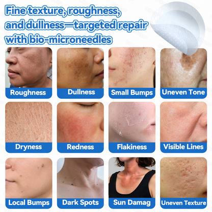 ✅ 𝐌𝗢𝑷𝙍𝙊® 𝟐-𝐢𝐧-𝟏 𝐌𝐢𝐜𝐫𝐨𝐧𝐞𝐞𝐝𝐥𝐞 & 𝐇𝐲𝐝𝐫𝐨𝐜𝐨𝐥𝐥𝐨𝐢𝐝 𝐏𝐚𝐭𝐜𝐡 | 𝐇𝐞𝐥𝐩𝐬 𝐒𝐮𝐩𝐩𝐨𝐫𝐭 𝐒𝐦𝐨𝐨𝐭𝐡, 𝐂𝐥𝐞𝐚𝐫-𝐋𝐨𝐨𝐤𝐢𝐧𝐠 𝐒𝐤𝐢𝐧 | 𝗗𝗮𝗶𝗹𝘆 𝗦𝗸𝗶𝗻 𝗖𝗮𝗿𝗲 𝗣𝗮𝘁𝗰𝗵𝗲𝘀 𝗜𝗻𝘃𝗶𝘀𝗶𝗯𝗹𝗲 𝗦𝘁𝗮𝗿 𝗣𝗶𝗺𝗽𝗹𝗲 𝗣𝗮𝘁𝗰𝗵𝗲𝘀 𝗳𝗼𝗿 𝗙𝗮𝗰𝗲 & 𝗕𝗼𝗱𝘆✅