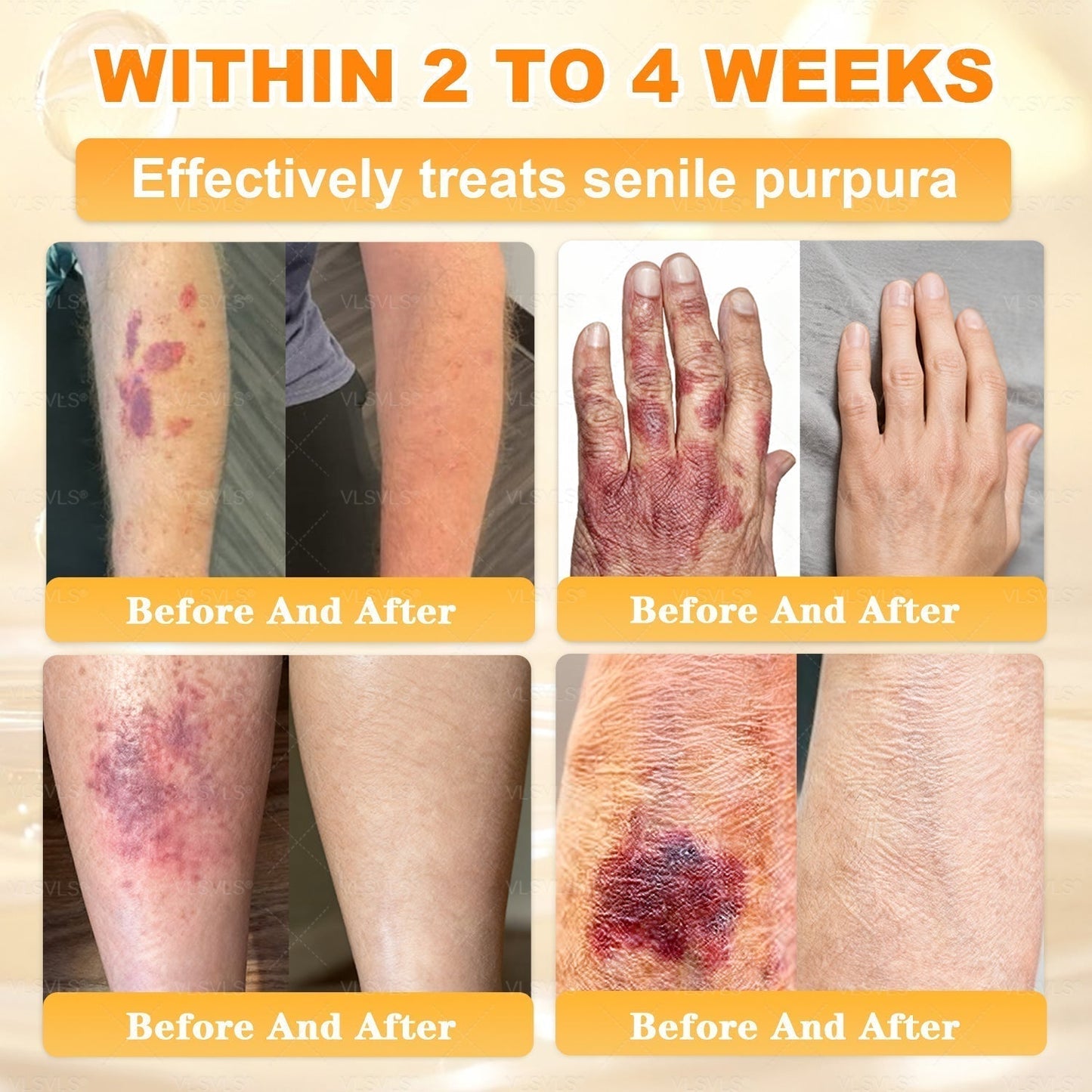 🔥 LAST DAY 80% OFF🔥 Aeehfeng® Bee Venom Skin Restoration Cream 🔥🔥