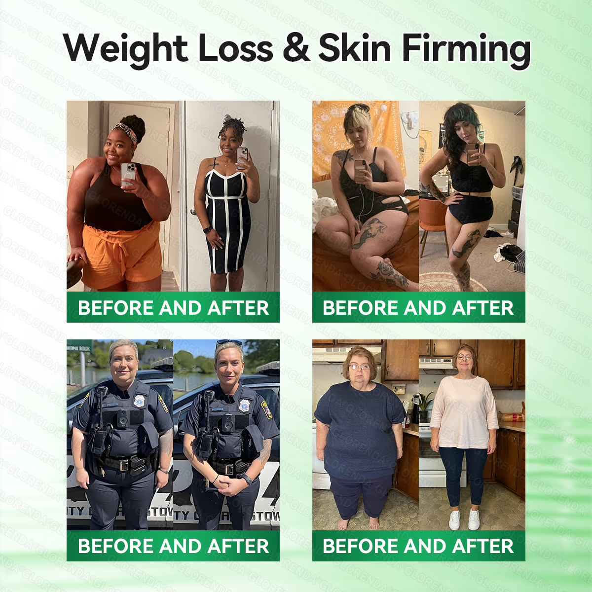 🧆🧆𝑶𝒇𝒇𝒊𝒄𝒊𝒂𝒍 𝑺𝒕𝒐𝒓𝒆  | 𝐆𝐋𝐎𝑹𝑬𝑵𝑫𝗔®𝑴𝒐𝒓𝒊𝒏𝒈𝗮 · 𝗕𝗲𝗿𝗯𝗲𝗿𝙞𝙣𝙚 × 𝙉𝘼𝐃+ 𝟏𝟎-𝐢𝐧-𝟏 𝙉𝙖𝙣𝙤 𝙈𝙞𝙘𝙧𝙤𝙣𝙚𝙚𝐝𝐥𝐞 𝐏𝐚𝐭𝙘𝙝(𝐉𝐮𝐬𝐭 𝐨𝐧𝐜𝐞 𝐚 𝐝𝐚𝐲, 𝐯𝐢𝐬𝐢𝐛𝐥𝐞 𝐜𝐡𝐚𝐧𝐠𝐞𝐬 𝐢𝐧 𝟕 𝐝𝐚𝐲𝐬） ✅ 𝐅𝐨𝐫 𝐨𝐛𝐞𝐬𝐢𝐭𝐲, 🅛🅞🅞🅢🅔 🅢🅚🅘🅝,𝐝𝐢𝐚𝐛𝐞𝐭𝐞𝐬, 𝐬𝐥𝐞𝐞𝐩 𝐚𝐩𝐧𝐞𝐚, 𝐣𝐨𝐢𝐧𝐭 𝐢𝐬𝐬𝐮𝐞𝐬, 𝐚𝐧𝐝 𝐦𝐨𝐫𝐞