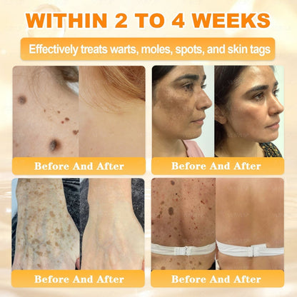 🔥 LAST DAY 80% OFF🔥 Aeehfeng® Bee Venom Skin Restoration Cream 🔥🔥