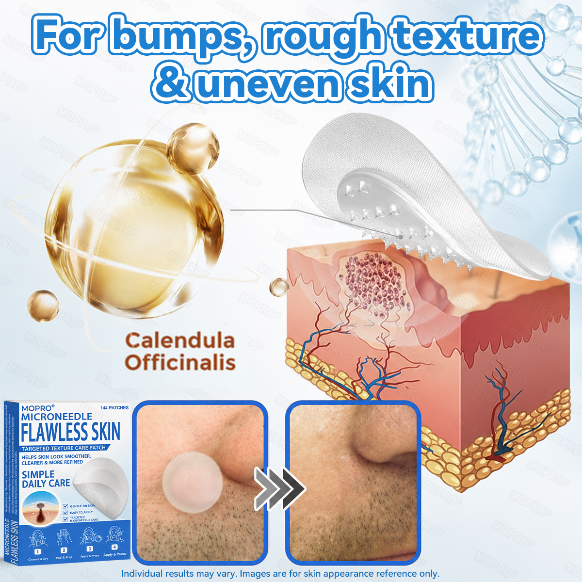 ✅ 𝐌𝗢𝑷𝙍𝙊® 𝟐-𝐢𝐧-𝟏 𝐌𝐢𝐜𝐫𝐨𝐧𝐞𝐞𝐝𝐥𝐞 & 𝐇𝐲𝐝𝐫𝐨𝐜𝐨𝐥𝐥𝐨𝐢𝐝 𝐏𝐚𝐭𝐜𝐡 | 𝐇𝐞𝐥𝐩𝐬 𝐒𝐮𝐩𝐩𝐨𝐫𝐭 𝐒𝐦𝐨𝐨𝐭𝐡, 𝐂𝐥𝐞𝐚𝐫-𝐋𝐨𝐨𝐤𝐢𝐧𝐠 𝐒𝐤𝐢𝐧 | 𝗗𝗮𝗶𝗹𝘆 𝗦𝗸𝗶𝗻 𝗖𝗮𝗿𝗲 𝗣𝗮𝘁𝗰𝗵𝗲𝘀 𝗜𝗻𝘃𝗶𝘀𝗶𝗯𝗹𝗲 𝗦𝘁𝗮𝗿 𝗣𝗶𝗺𝗽𝗹𝗲 𝗣𝗮𝘁𝗰𝗵𝗲𝘀 𝗳𝗼𝗿 𝗙𝗮𝗰𝗲 & 𝗕𝗼𝗱𝘆✅